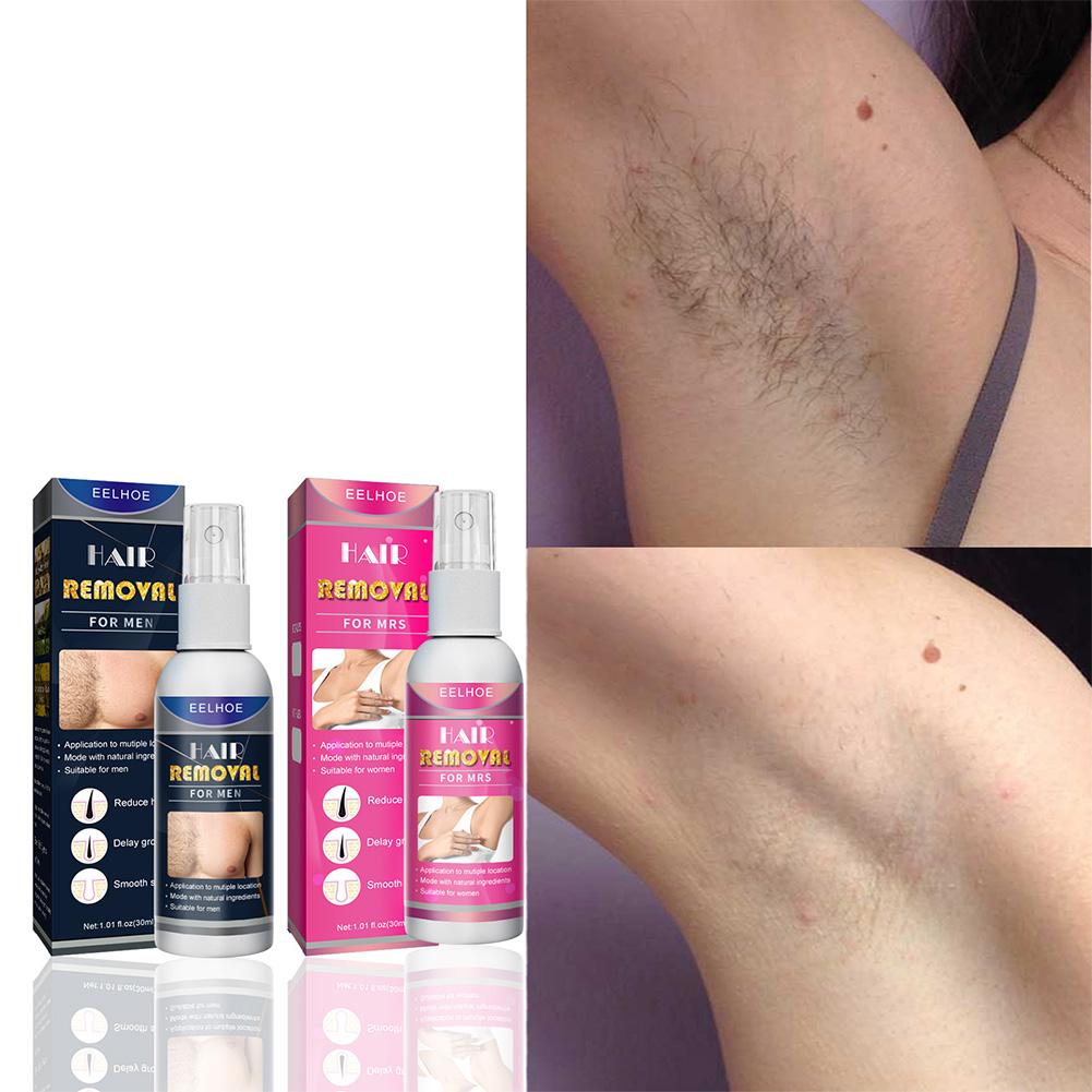 1/2 шт. супер натуральное безб – обзор и цена Hair Care Lotion